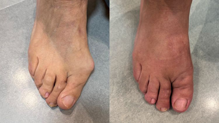 Antes y después de un proceso quirúrgico